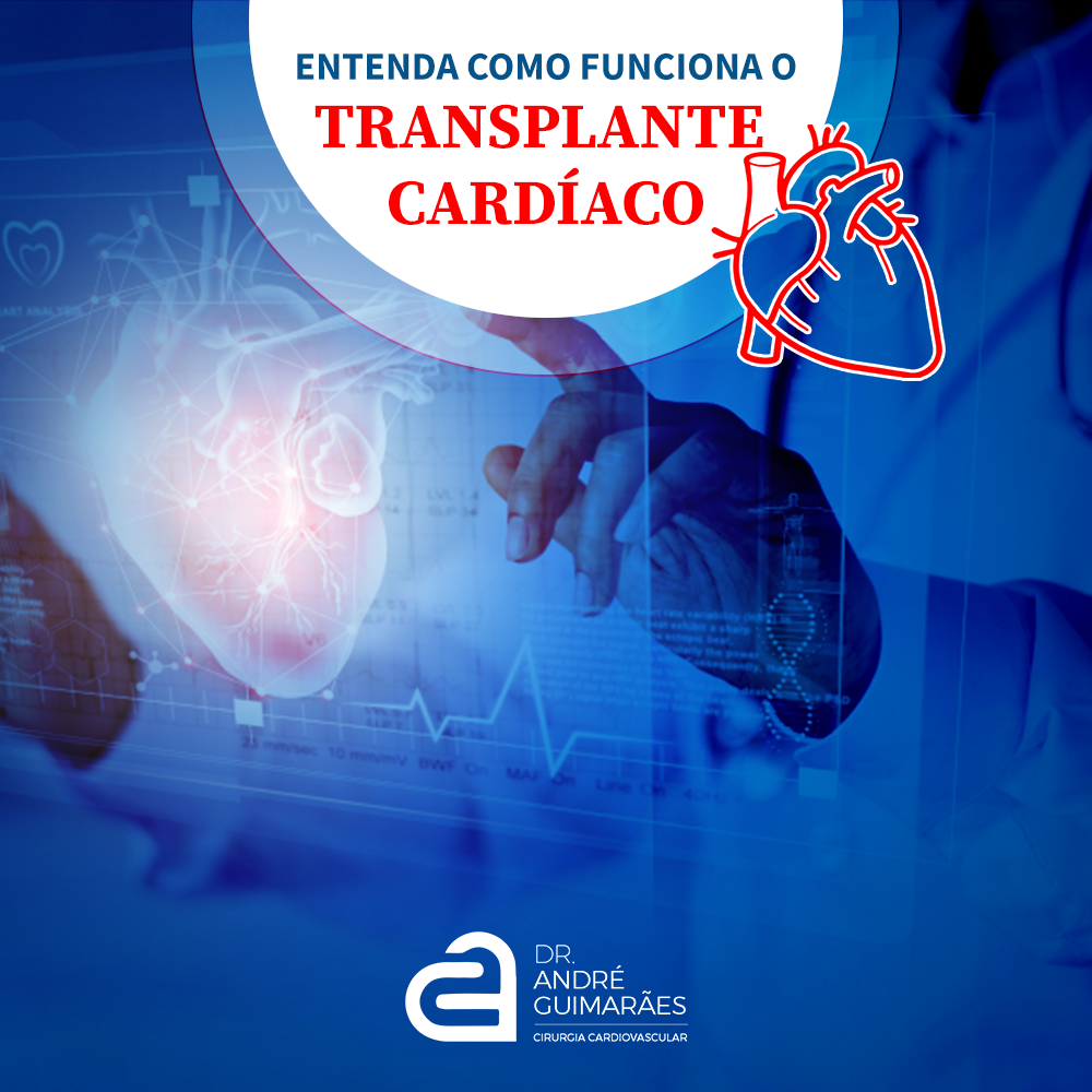 Transplante Cardíaco